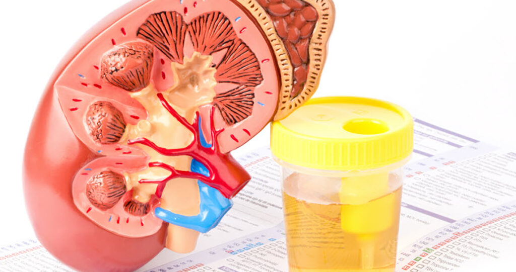 Kidney Function Test