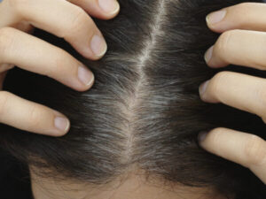 Wellhealthorganic.com know the causes of white hair and easy ways to prevent it naturally